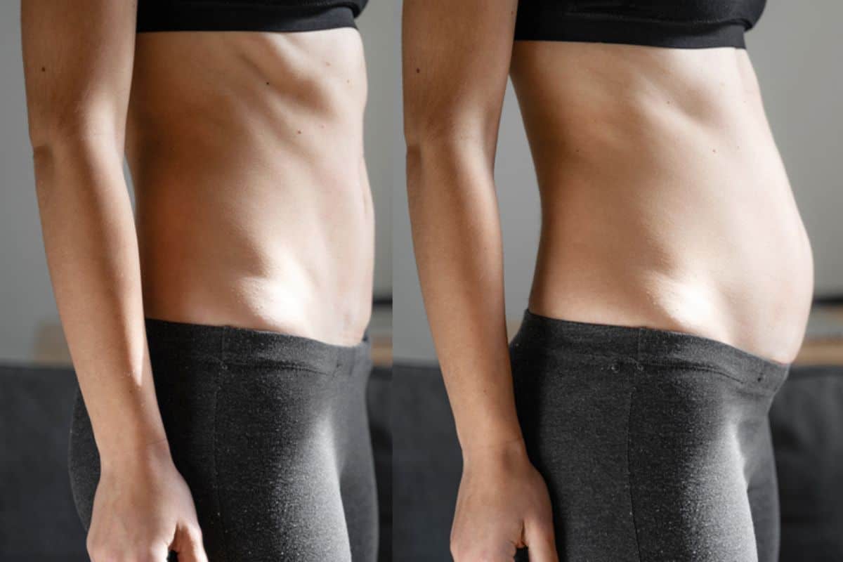 How long does diastasis recti take to improve ?