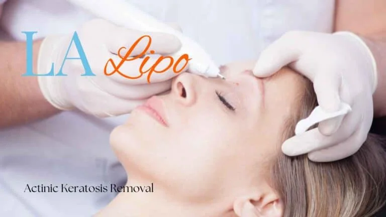 Woman receiving Actinic Keratosis Removal Treatment