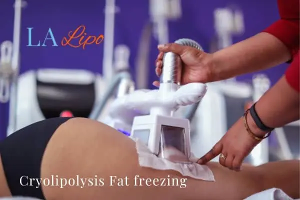 women getting fat freezing