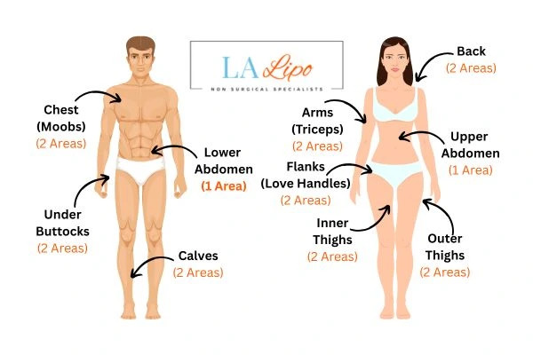 LA LIPO Cryolipolysis Areas