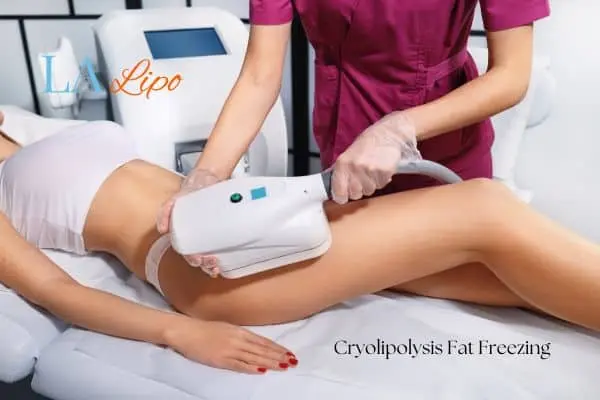 Woman receiving coolsculpting treatment on her thighs