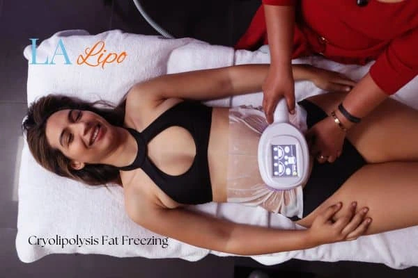 woman getting cryolipolysis