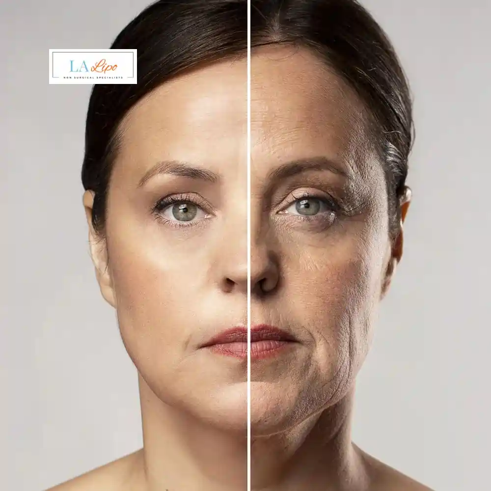 How Can You Tell If Non-Surgical Skin Tightening Is Right for You ?