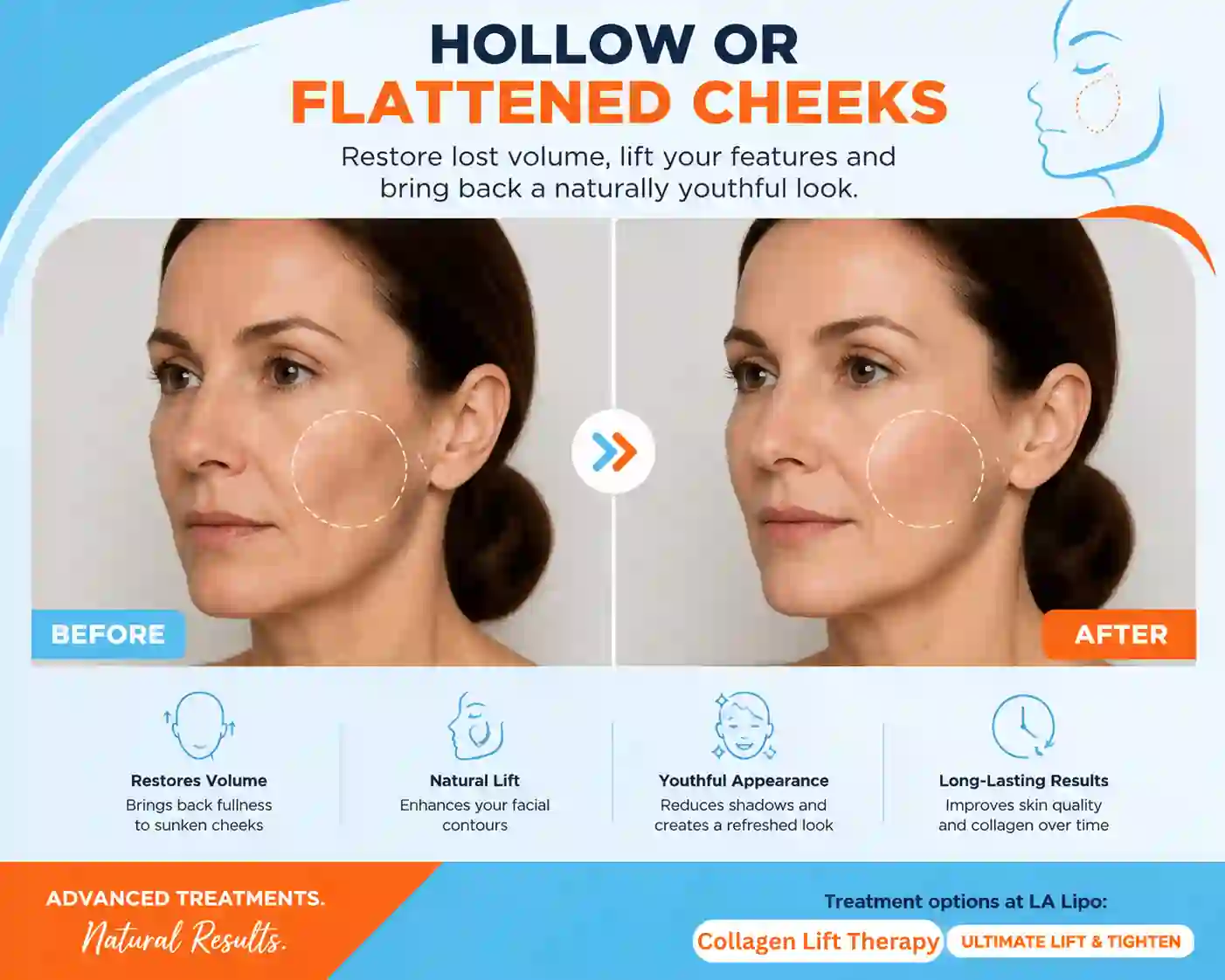 Sign #4: Hollow or Flattened Cheeks