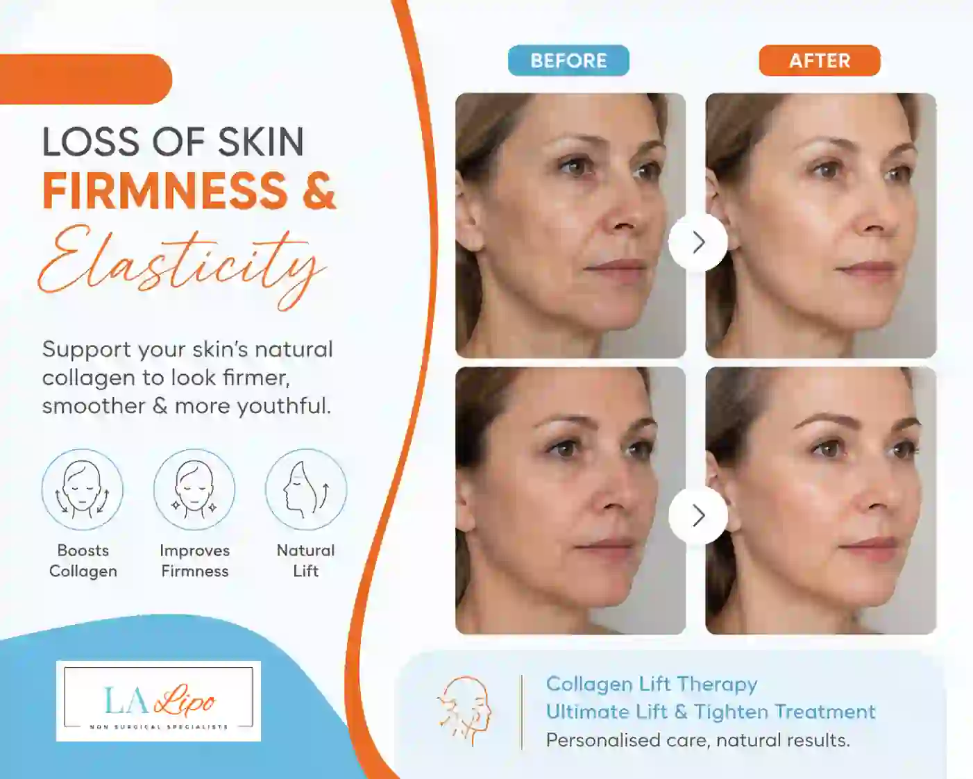 Sign #7: Loss of Skin Firmness and Elasticity