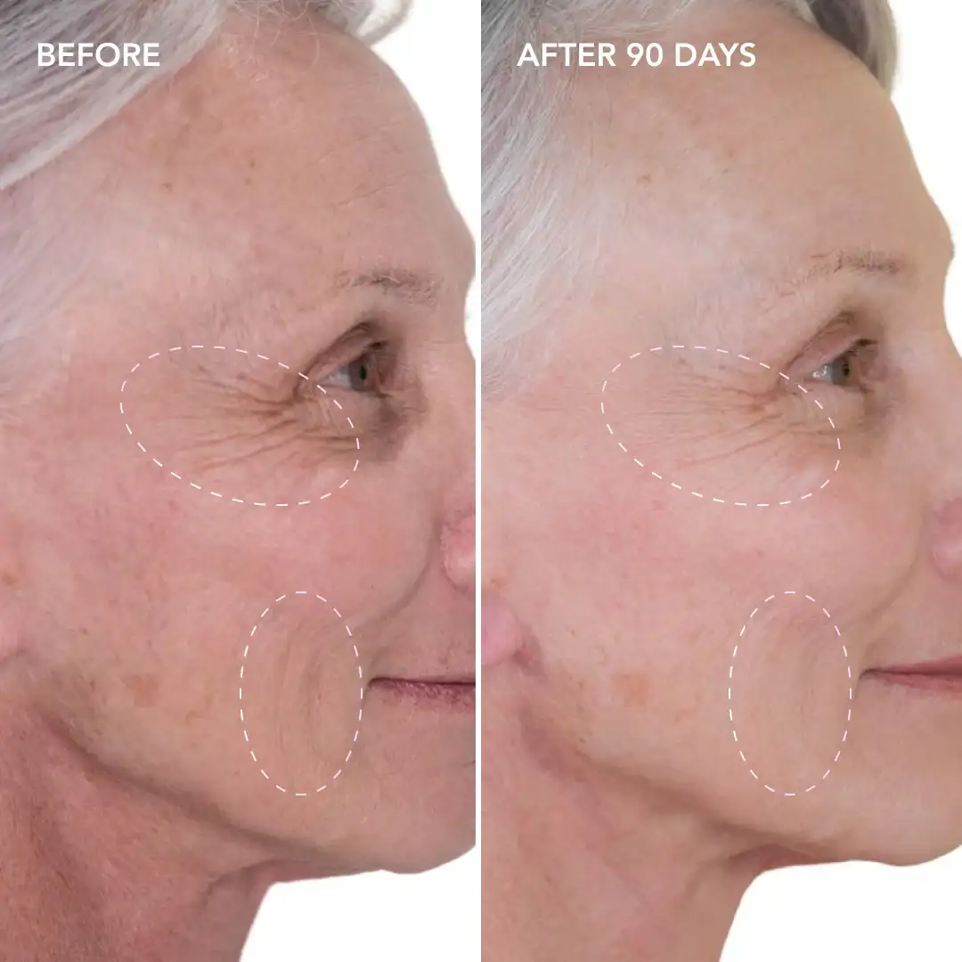 When will you see results